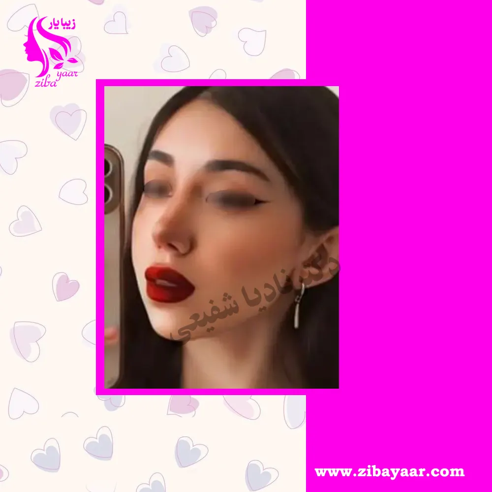 جراحی بینی دکتر نادیا شفیعی